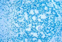 Các báo cáo mới cho thấy ngành trị liệu gen và tế bào của Philly đang ‘phát triển nhanh chóng’. Liệu nó có thể trở thành trung tâm nghiên cứu và đổi mới hàng đầu không?